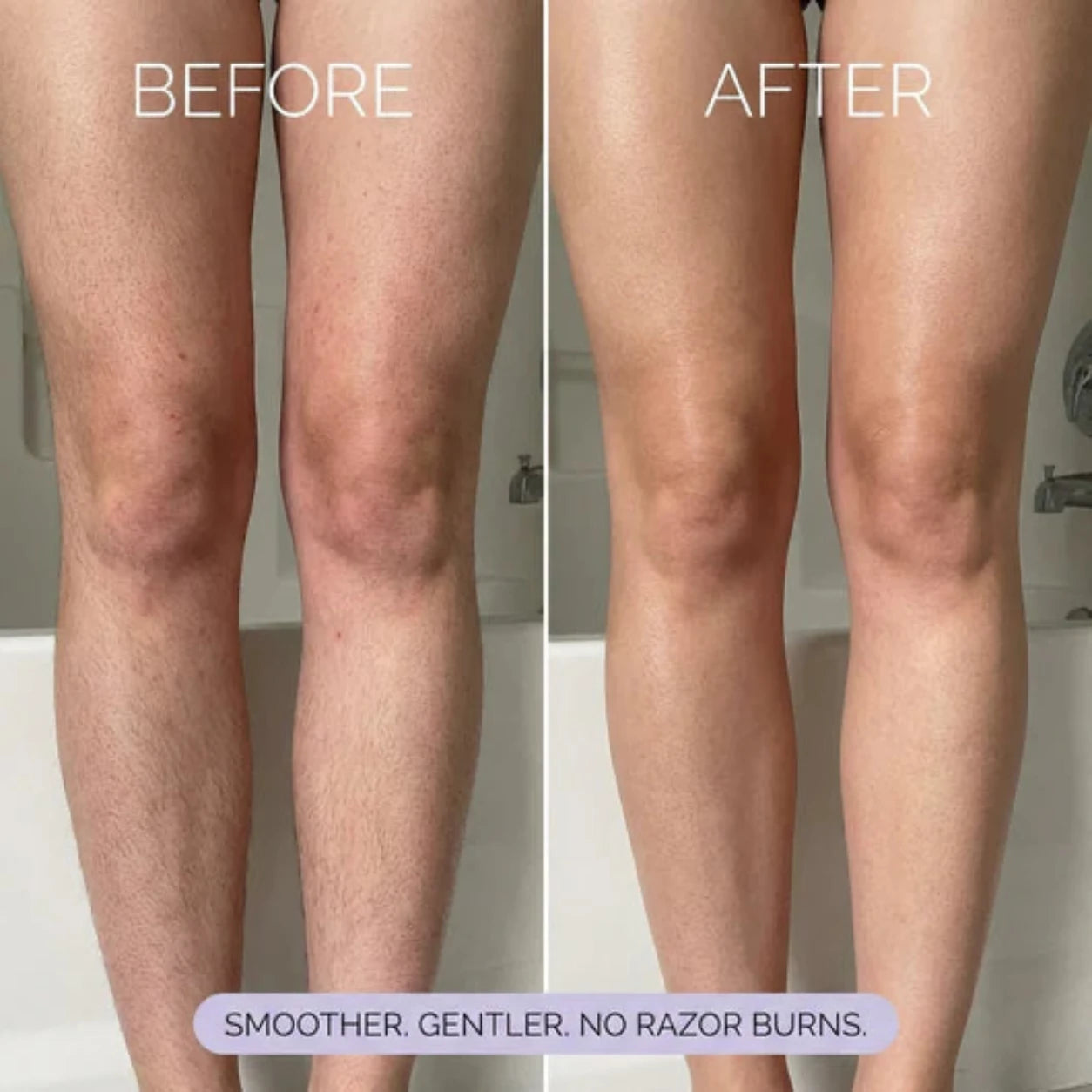 Velya - Hair Removal Mousse