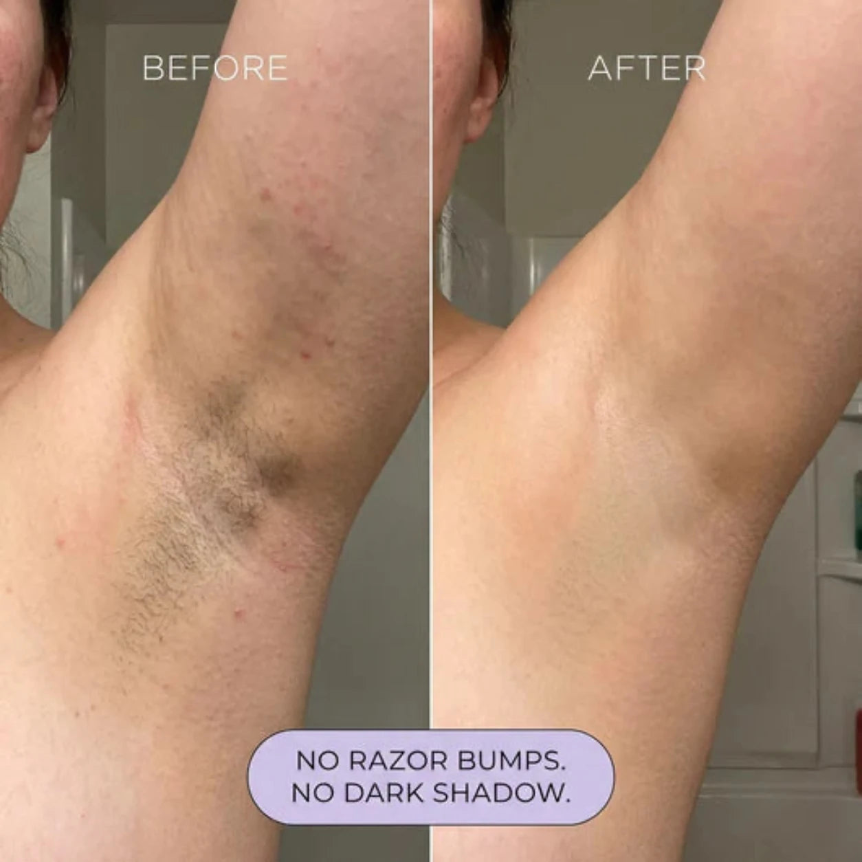 Velya - Hair Removal Mousse